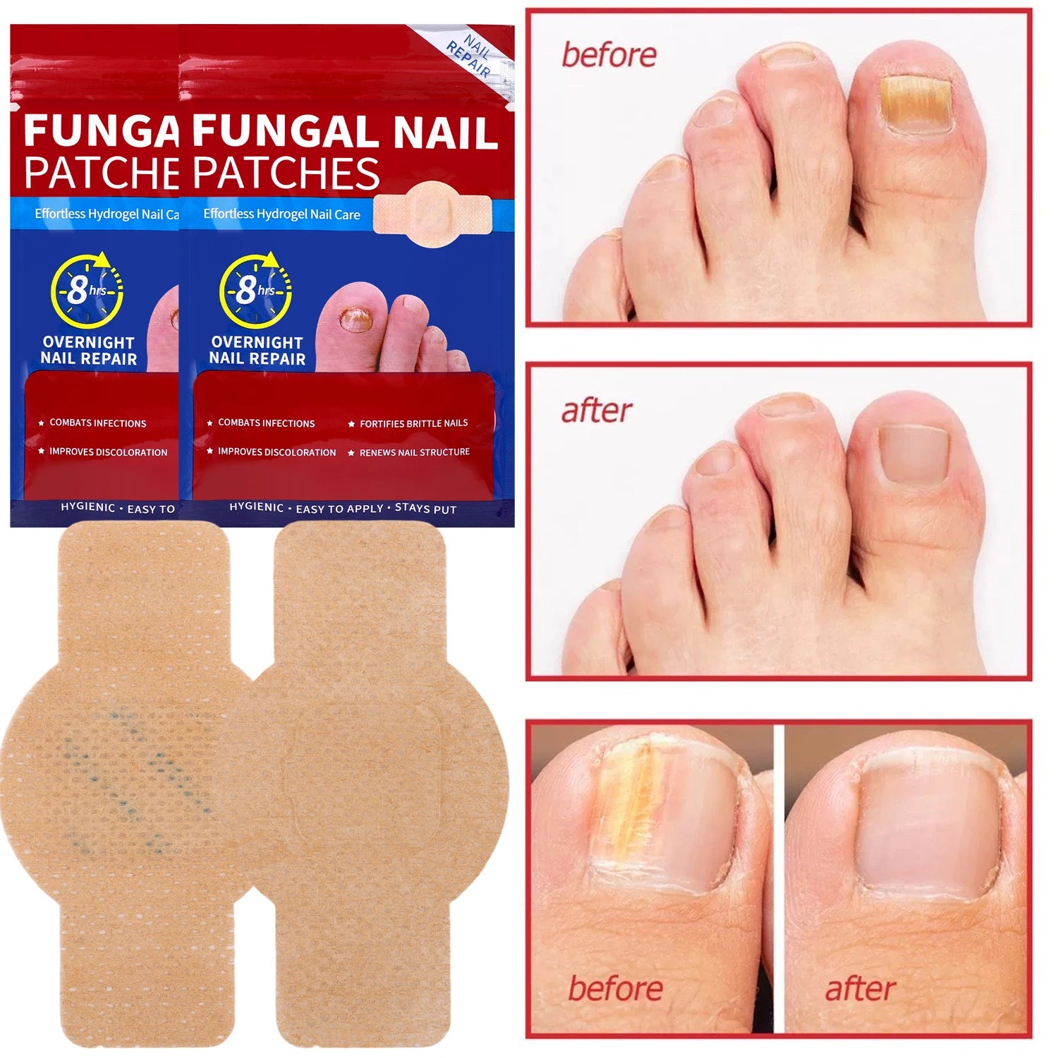 FungasFree Patches